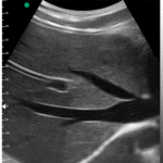 LiverThyroidCarotid_02-1