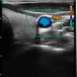 LiverThyroidCarotid_03-1