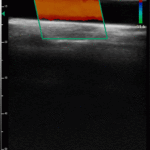 LiverThyroidCarotid_04-454x454