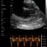 phased-cardiac-PW1-752x752 (1)