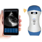 Multipurpose Handheld Wireless Color Doppler Ultrasound