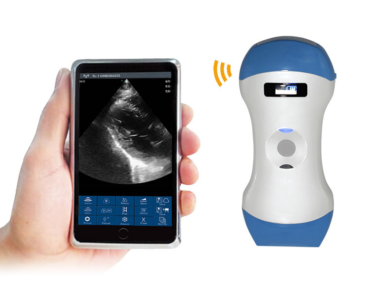 Multipurpose Handheld Wireless Color Doppler Ultrasound