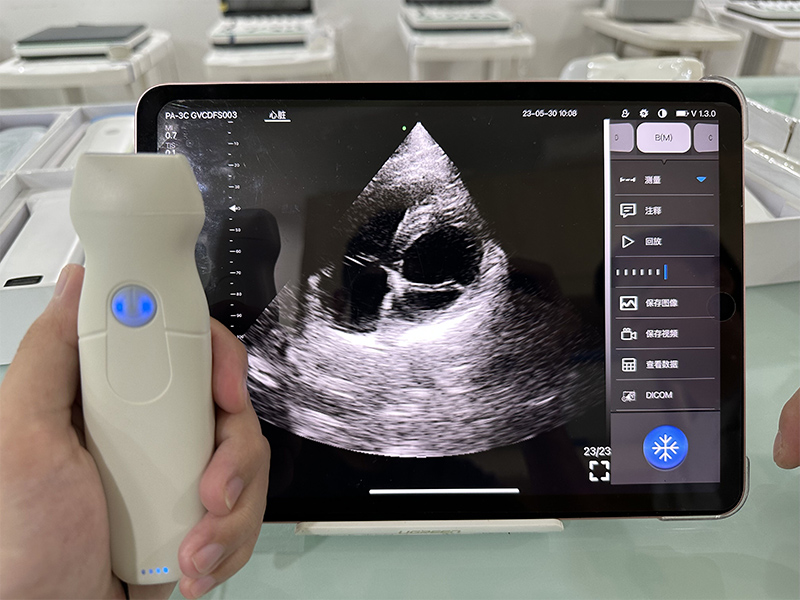 Handheld Wireless Color Doppler Ultrasound for Cardiac