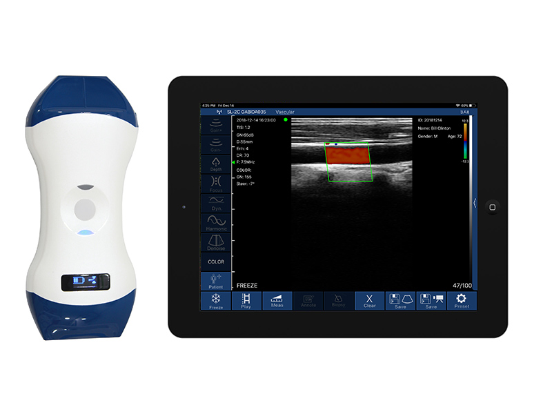 Handheld Wireless Color Doppler Ultrasound for Physical Medicine