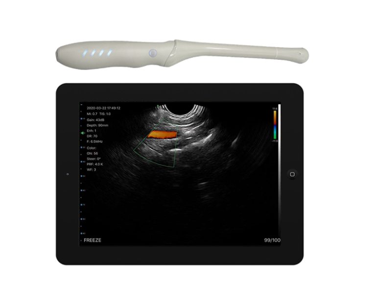 tvs-wireless-ultrasound