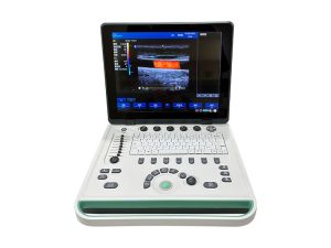 Portable Color doppler ultrasound