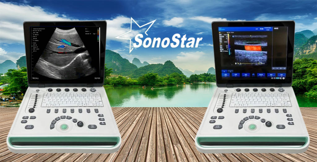 Portable Color doppler ultrasound machine two