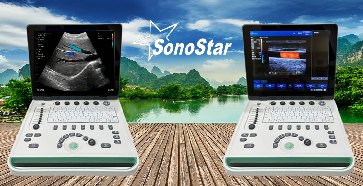 Portable Color doppler ultrasound machine two