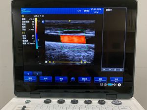 Portable Color doppler ultrasound machine1