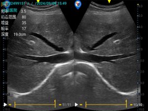 Portable Color doppler ultrasound machine5