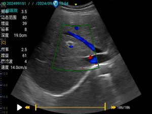 Portable Color doppler ultrasound machine6