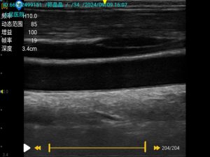 Portable Color doppler ultrasound machine9